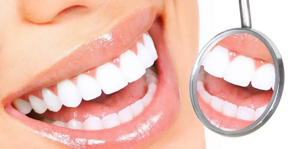Hollywood Smile Dental